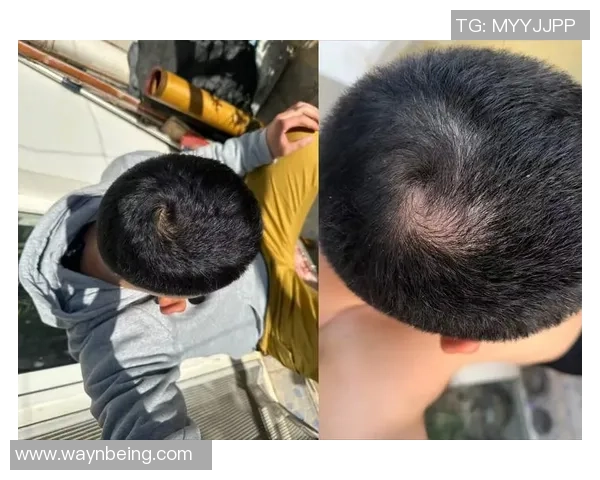 秃顶足球球星如何应对发量困扰与职业生涯的挑战 秃顶足球球星如何应对发量困扰与职业生涯的挑战